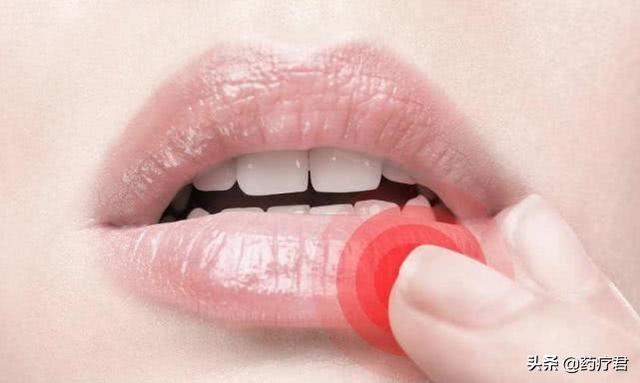 吃维生素B2能治嘴破口角炎吗